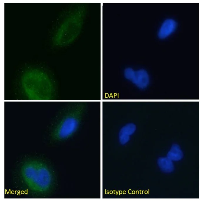 Immunocytochemistry - Anti-BACE2 antibody [1/9] (AB245679)