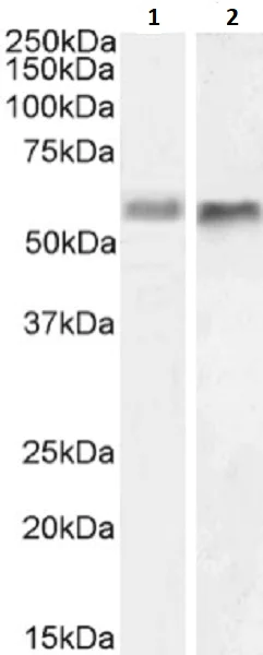 Western blot - Anti-BACE2 antibody [1/9] (AB245679)
