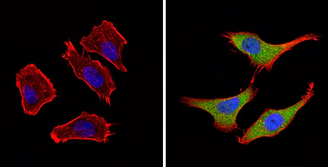 Immunocytochemistry/ Immunofluorescence - Anti-BACE2 antibody (AB5670)