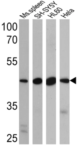 Western blot - Anti-BACE2 antibody (AB5670)