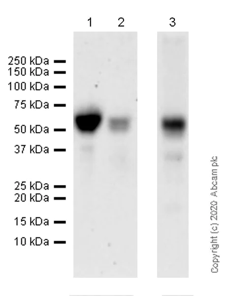 Western blot - Anti-BACE2 antibody [EPR23339-221] (AB270458)
