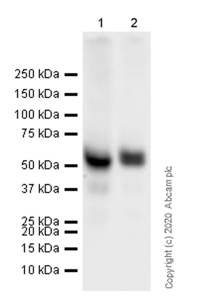 Western blot - Anti-BACE2 antibody [EPR23339-221] (AB270458)