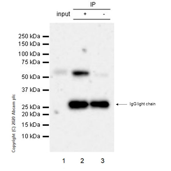 Immunoprecipitation - Anti-BACE2 antibody [EPR23339-221] - BSA and Azide free (AB270616), expandable thumbnail