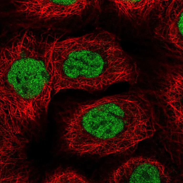 Immunocytochemistry/ Immunofluorescence - Anti-BACH1 Antibody (AB327225)
