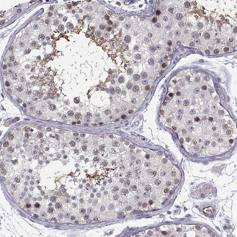 Immunohistochemistry (Formalin/PFA-fixed paraffin-embedded sections) - Anti-BACH1 Antibody (AB327225)