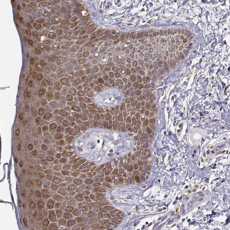 Immunohistochemistry (Formalin/PFA-fixed paraffin-embedded sections) - Anti-BACH1 Antibody (AB327225)