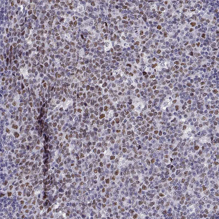 Immunohistochemistry (Formalin/PFA-fixed paraffin-embedded sections) - Anti-BACH1 Antibody (AB327225)