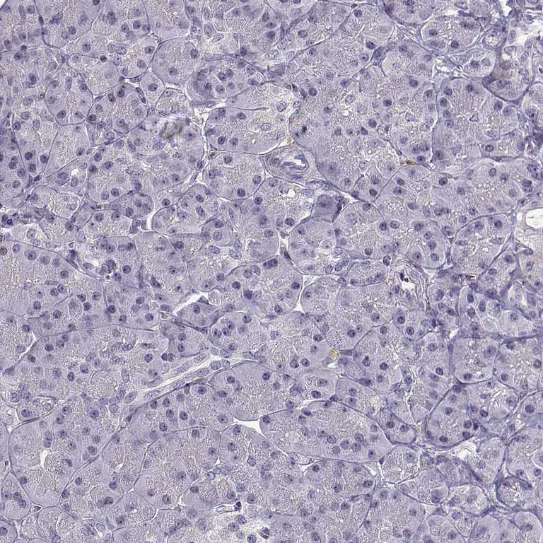 Immunohistochemistry (Formalin/PFA-fixed paraffin-embedded sections) - Anti-BACH1 Antibody (AB327225)