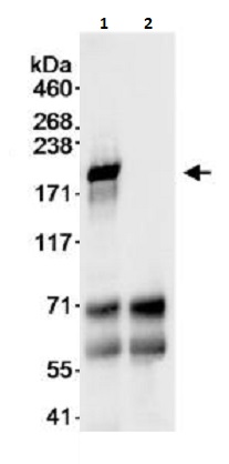 Immunoprecipitation - Anti-BACH1/BRIP1 antibody (AB264133)