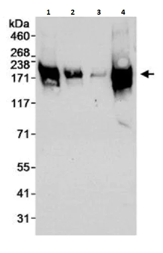 Western blot - Anti-BACH1/BRIP1 antibody (AB264133)