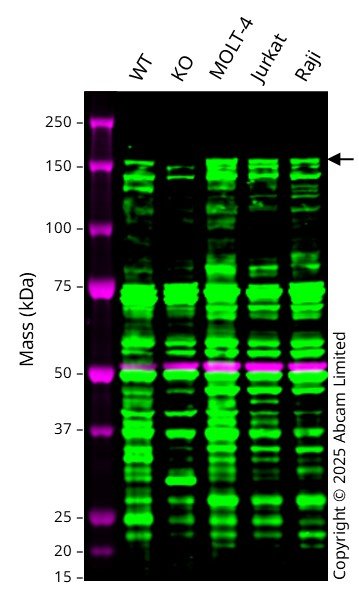 Western blot - Anti-BACH1/BRIP1 antibody (AB49657)