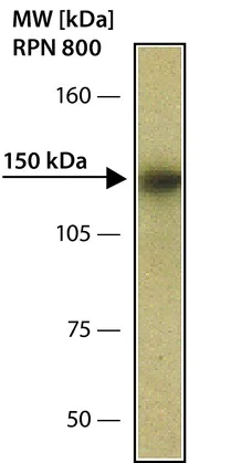 Western blot - Anti-BACH1/BRIP1 antibody (AB49657)