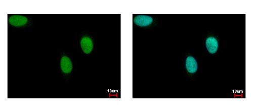 Immunocytochemistry/ Immunofluorescence - Anti-BACH1/BRIP1 antibody - N-terminal (AB151509), expandable thumbnail