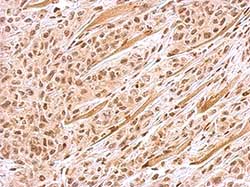Immunohistochemistry (Formalin/PFA-fixed paraffin-embedded sections) - Anti-BACH1/BRIP1 antibody - N-terminal (AB151509), expandable thumbnail