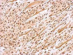 Immunohistochemistry (Formalin/PFA-fixed paraffin-embedded sections) - Anti-BACH1/BRIP1 antibody - N-terminal (AB151509)