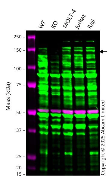Western blot - Anti-BACH1/BRIP1 antibody - N-terminal (AB151509)