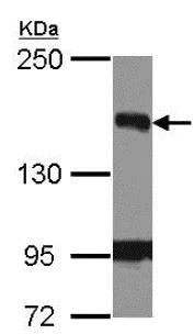 Western blot - Anti-BACH1/BRIP1 antibody - N-terminal (AB151509)
