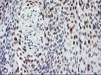 Immunohistochemistry (Formalin/PFA-fixed paraffin-embedded sections) - Anti-BACH1.3 antibody [OTI4E11] (AB128486)