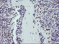 Immunohistochemistry (Formalin/PFA-fixed paraffin-embedded sections) - Anti-BACH1.3 antibody [OTI4E11] (AB128486), expandable thumbnail