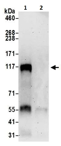 Immunoprecipitation - Anti-BACH2 antibody (AB226394)