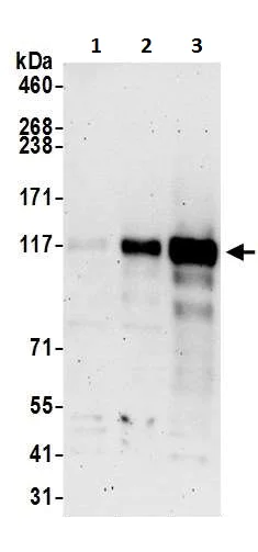 Western blot - Anti-BACH2 antibody (AB226394)