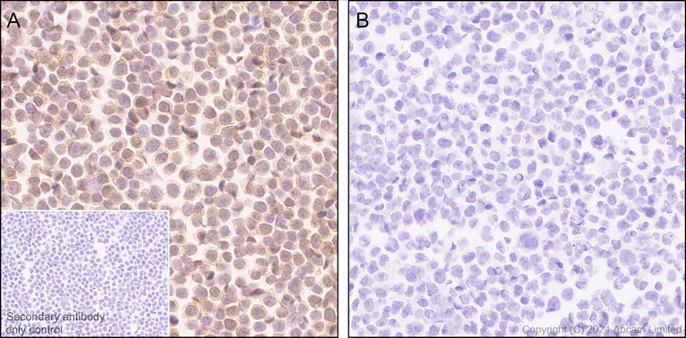 Immunohistochemistry (Formalin/PFA-fixed paraffin-embedded sections) - Anti-BACH2 antibody [EPR28026-43] (AB320721)