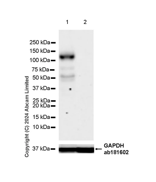 Western blot - Anti-BACH2 antibody [EPR28026-43] (AB320721)
