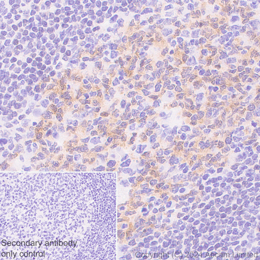 Immunohistochemistry (Formalin/PFA-fixed paraffin-embedded sections) - Anti-BACH2 antibody [EPR28026-43] - BSA and Azide free (ab320722), expandable thumbnail