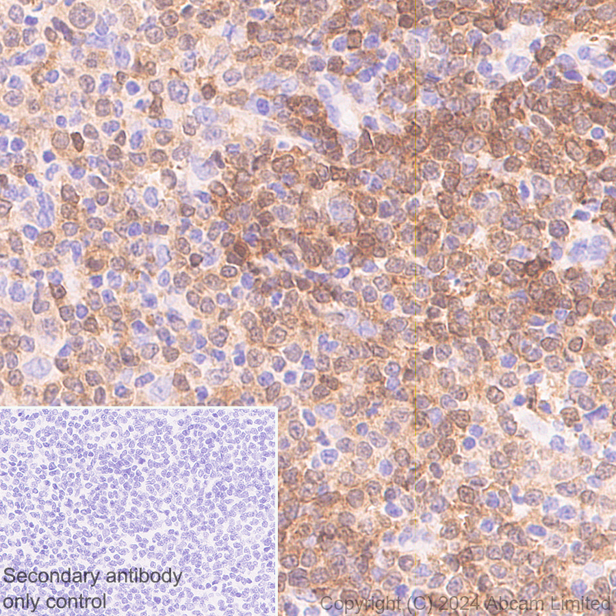 Immunohistochemistry (Formalin/PFA-fixed paraffin-embedded sections) - Anti-BACH2 antibody [EPR28026-43] - BSA and Azide free (ab320722), expandable thumbnail