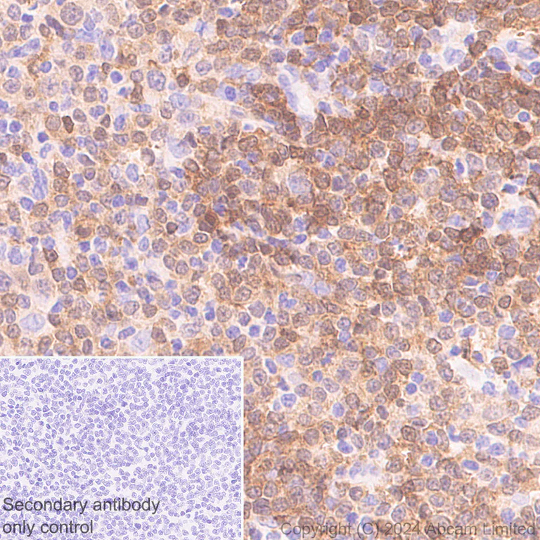 Immunohistochemistry (Formalin/PFA-fixed paraffin-embedded sections) - Anti-BACH2 antibody [EPR28026-43] - BSA and Azide free (AB320722)