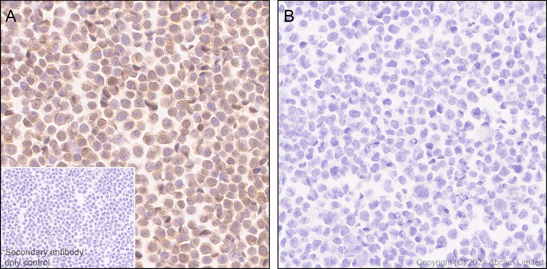 Immunohistochemistry (Formalin/PFA-fixed paraffin-embedded sections) - Anti-BACH2 antibody [EPR28026-43] - BSA and Azide free (ab320722), expandable thumbnail