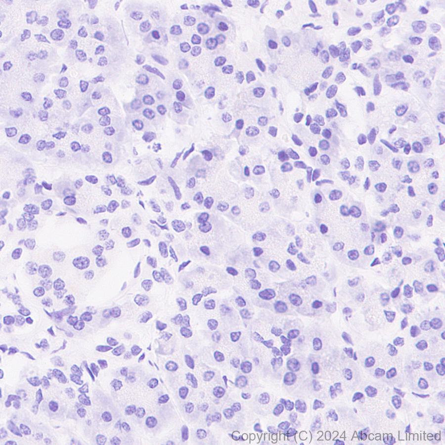Immunohistochemistry (Formalin/PFA-fixed paraffin-embedded sections) - Anti-BACH2 antibody [EPR28026-43] - BSA and Azide free (ab320722), expandable thumbnail