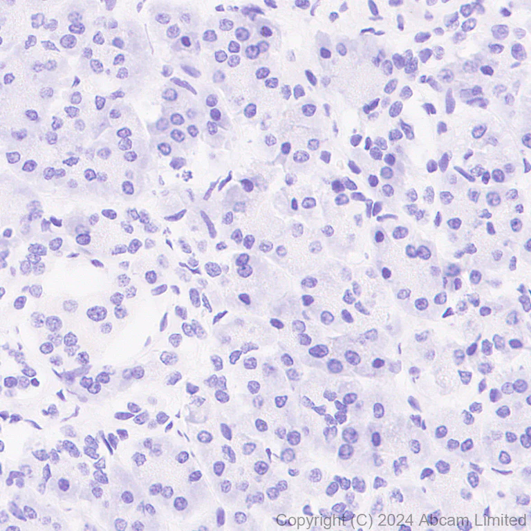 Immunohistochemistry (Formalin/PFA-fixed paraffin-embedded sections) - Anti-BACH2 antibody [EPR28026-43] - BSA and Azide free (AB320722)