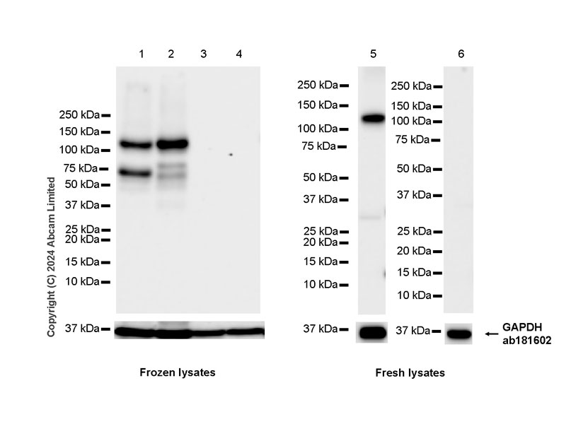 Western blot - Anti-BACH2 antibody [EPR28026-43] - BSA and Azide free (ab320722), expandable thumbnail