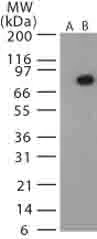 Western blot - Anti-Bacillus anthracis protective antigen antibody (AB13808)