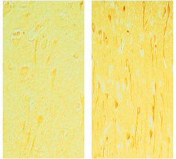 Immunohistochemistry (Formalin/PFA-fixed paraffin-embedded sections) - Anti-Bad antibody (AB90435)