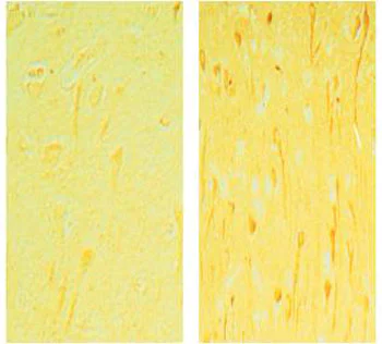 Immunohistochemistry (Formalin/PFA-fixed paraffin-embedded sections) - Anti-Bad antibody (AB90435)