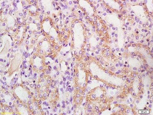 Immunohistochemistry (Formalin/PFA-fixed paraffin-embedded sections) - Anti-Bad (phospho S128) antibody (AB216829)