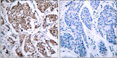 Immunohistochemistry (Formalin/PFA-fixed paraffin-embedded sections) - Anti-Bad (phospho S155) antibody (AB28825)