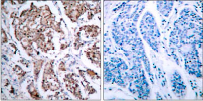 Immunohistochemistry (Formalin/PFA-fixed paraffin-embedded sections) - Anti-Bad (phospho S155) antibody (AB28825)