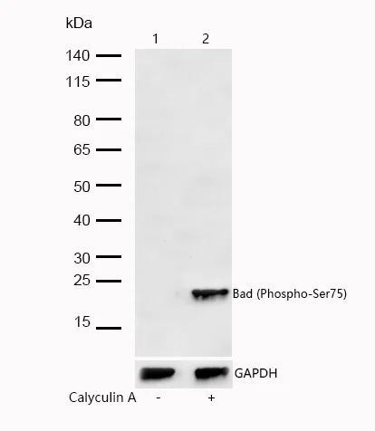 Western blot - Anti-Bad (phospho S75) antibody [SR1363] (AB326660)