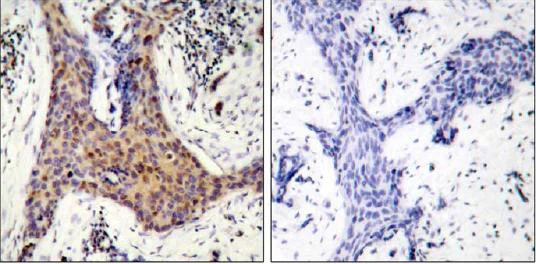 Immunohistochemistry (Formalin/PFA-fixed paraffin-embedded sections) - Anti-Bad (phospho S99) antibody (AB28824)