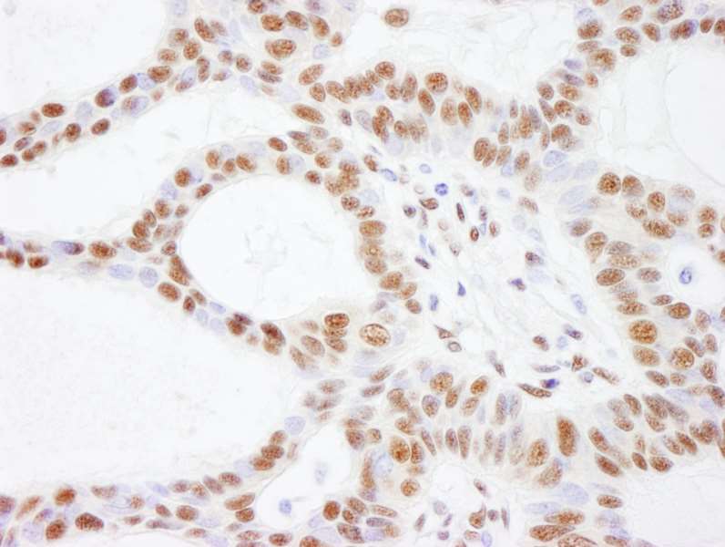 Immunohistochemistry (Formalin/PFA-fixed paraffin-embedded sections) - Anti-BAF170 antibody (AB264170), expandable thumbnail