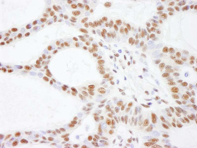 Immunohistochemistry (Formalin/PFA-fixed paraffin-embedded sections) - Anti-BAF170 antibody (AB264170)