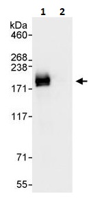 Immunoprecipitation - Anti-BAF170 antibody (AB264170), expandable thumbnail