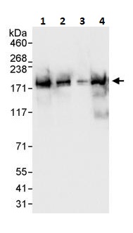 Western blot - Anti-BAF170 antibody (AB264170), expandable thumbnail