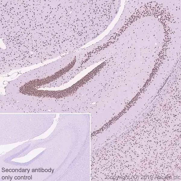 Immunohistochemistry (Formalin/PFA-fixed paraffin-embedded sections) - Anti-BAF170 antibody [EPR23066-21] - BSA and Azide free (AB263871)