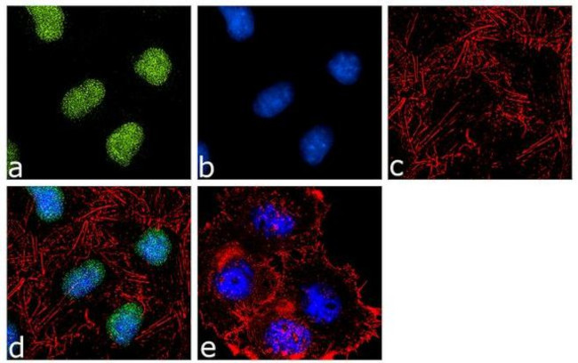 Immunocytochemistry/ Immunofluorescence - Anti-BAF53A Antibody [RP23040194] (AB313478), expandable thumbnail