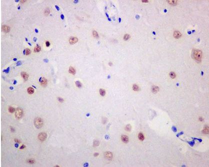 Immunohistochemistry (Formalin/PFA-fixed paraffin-embedded sections) - Anti-BAF53b antibody [EP10101] - BSA and Azide free (AB284832), expandable thumbnail