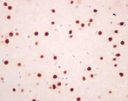 Immunohistochemistry (Formalin/PFA-fixed paraffin-embedded sections) - Anti-BAF53b antibody [EP10101] - BSA and Azide free (AB284832), expandable thumbnail